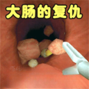 肠道检查HD官方下载